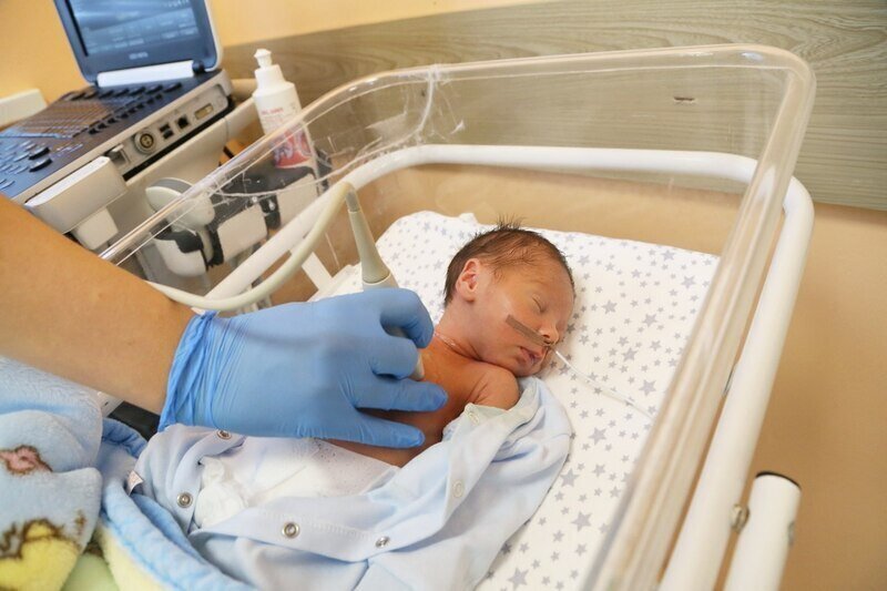 В Перинатальном центре начали внедрять малоинвазивный метод лечения недоношенных детей