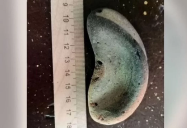 В Евпатории почти за 21 млн рублей продают 8-сантиметровый камень в форме человеческого органа