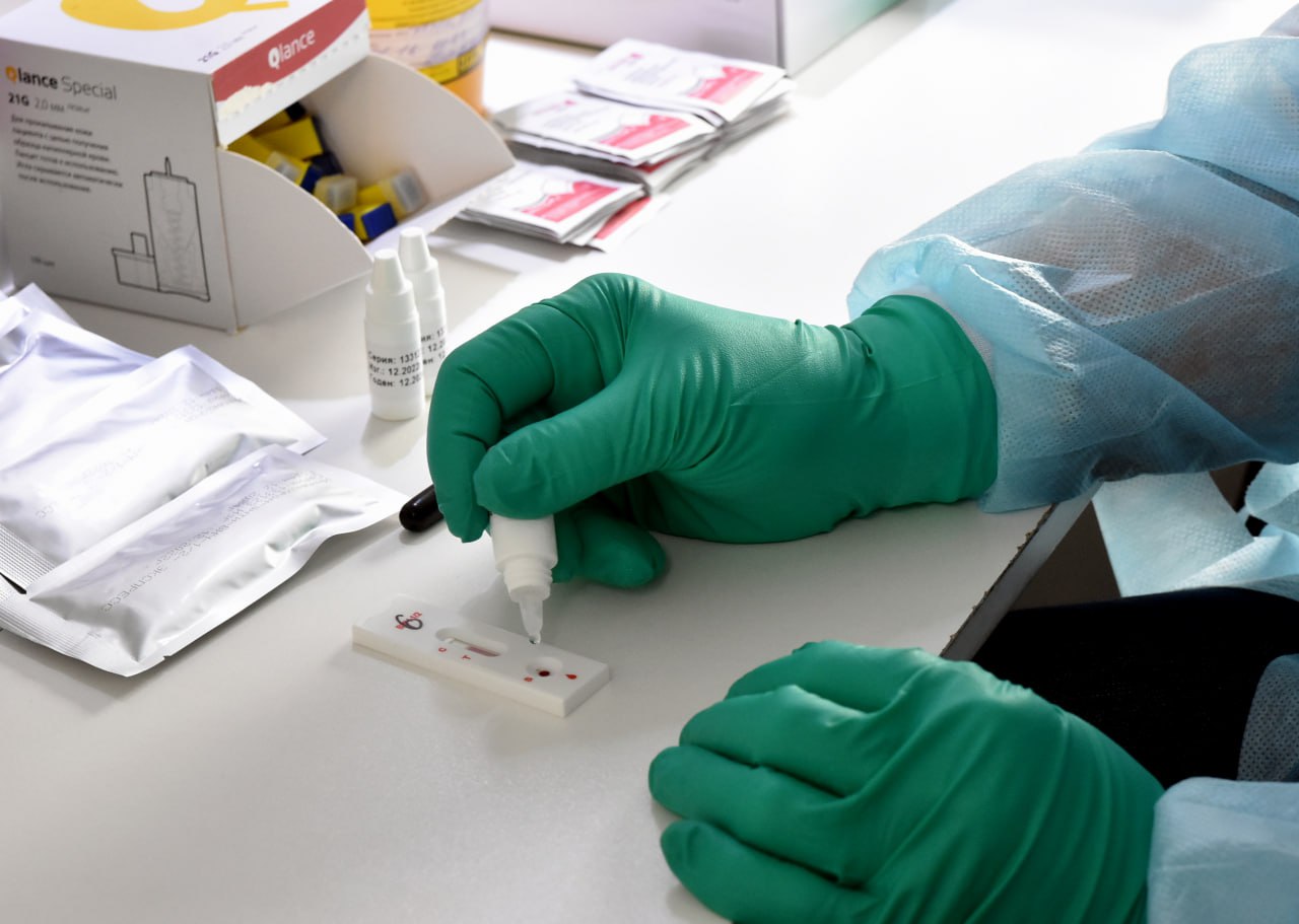 В Симферополе 27 ноября можно бесплатно пройти тестирование на антитела к ВИЧ 