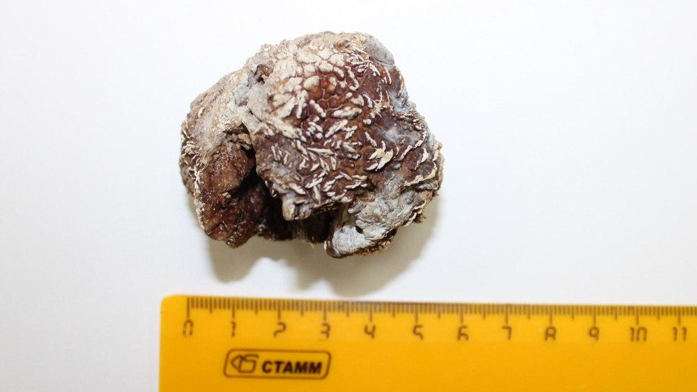 Новый тренд: желчные камни как товар и ингредиент для медицины